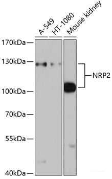 Western blot analysis of extracts of Mouse large intestine using MC3R Polyclonal Antibody.