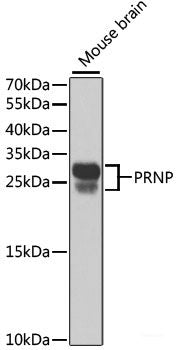Immunohistochemistry of paraffin-embedded Rat pancreas using MCM4 Polyclonal Antibody at dilution of 1:100 (40x lens).