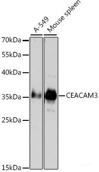 Immunohistochemistry of paraffin-embedded Rat kidney using MMP10 Polyclonal Antibody at dilution of 1:100 (40x lens).