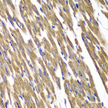 Western blot analysis of extracts of various cell lines using CHRNA10 Polyclonal Antibody at dilution of 1:1000.