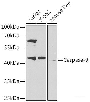 Western blot analysis of extracts of various cell lines using TPM2 Polyclonal Antibody at dilution of 1:400.