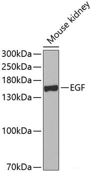 Immunohistochemistry of paraffin-embedded Human stomach using SSTR2 Polyclonal Antibody at dilution of 1:100 (40x lens).
