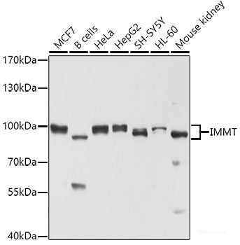Western blot analysis of extracts of various cell lines using MonoMethyl-Histone H3-R8 Polyclonal Antibody.