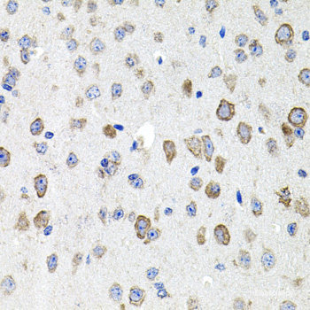 Immunohistochemistry of paraffin-embedded Mouse liver using YKL-40 / CHI3L1 Polyclonal Antibody at dilution of 1:100 (40x lens).