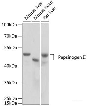 Immunofluorescence analysis of HeLa cells using CSF2RA Polyclonal Antibody at dilution of 1:100 (40x lens). Blue: DAPI for nuclear staining.