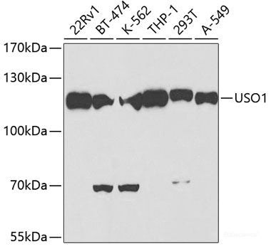 Immunofluorescence analysis of Rat kidney using LCN2 Polyclonal Antibody at dilution of 1:100. Blue: DAPI for nuclear staining.