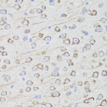 Immunofluorescence analysis of U2OS cells using ITGA6 Polyclonal Antibody at dilution of 1:100. Blue: DAPI for nuclear staining.