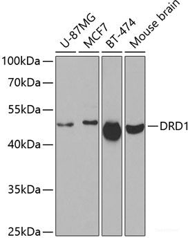 Immunohistochemistry of paraffin-embedded Human colon using UFD1L Polyclonal Antibody at dilution of 1:100 (40x lens).