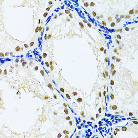 Immunohistochemistry of paraffin-embedded Human stomach using ASK1 Polyclonal Antibody