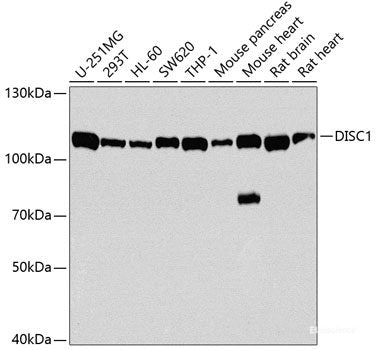 Immunohistochemistry of paraffin-embedded Rat brain using SMO Polyclonal Antibody