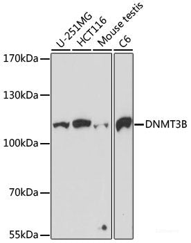 Immunofluorescence analysis of C6 cells using SUV39H1 Polyclonal Antibody at dilution of 1:100 (40x lens). Blue: DAPI for nuclear staining.