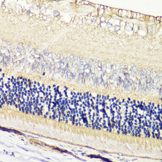 Immunohistochemistry of paraffin-embedded Rat testis using SLC39A7 Polyclonal Antibody at dilution of 1:100 (40x lens).