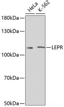 Western blot analysis of extracts of various cell lines using TMED9 Polyclonal Antibody at dilution of 1:3000.