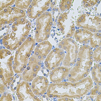 Western blot analysis of extracts from normal (control) and CSPG4 knockout (KO) HeLa cells using CSPG4 Polyclonal Antibody at dilution of 1:500.