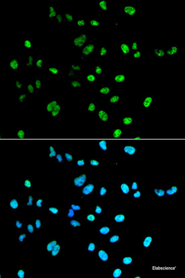 Immunofluorescence analysis of A549 cells using RAB31 Polyclonal Antibody