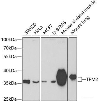 Western blot analysis of extracts of various cell lines using AMFR Polyclonal Antibody at dilution of 1:1000.