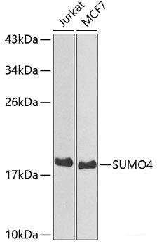 Immunofluorescence analysis of HeLa cells using ARF5 Polyclonal Antibody at dilution of 1:100. Blue: DAPI for nuclear staining.