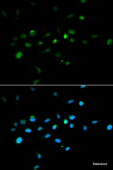 Western blot analysis of extracts of various cell lines using ARHGAP1 Polyclonal Antibody at dilution of 1:1000.