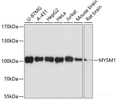 Immunohistochemistry of paraffin-embedded Human stomach using ASNA1 Polyclonal Antibody at dilution of 1:100 (40x lens).