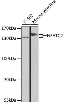 Immunohistochemistry of paraffin-embedded Human breast cancer using ATP5J Polyclonal Antibody at dilution of 1:100 (40x lens).