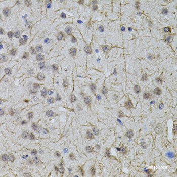 Immunofluorescence analysis of Raw264.7 cells using ENTPD1/CD39 Polyclonal Antibody at dilution of 1:100 (40x lens). Blue: DAPI for nuclear staining.