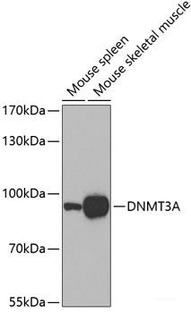 Immunohistochemistry of paraffin-embedded Human stomach using DYNC1I1 Polyclonal Antibody at dilution of 1:100 (40x lens).