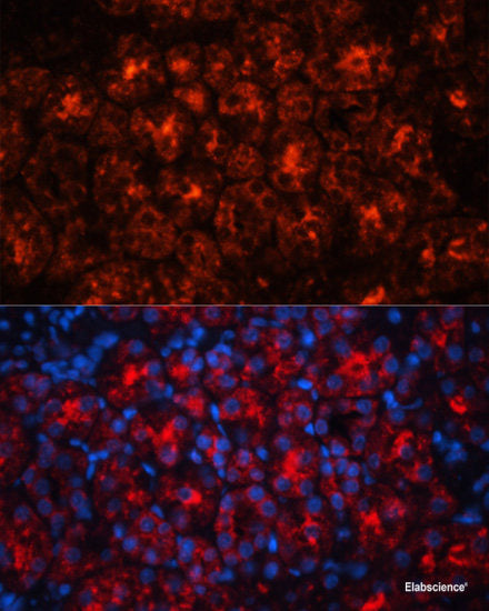 Immunohistochemistry of paraffin-embedded Rat brain using EIF4A2 Polyclonal Antibody at dilution of 1:100 (40x lens).