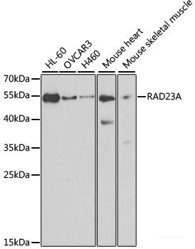 Western blot analysis of extracts of SW480 cells using FUT6 Polyclonal Antibody at dilution of 1:1000.