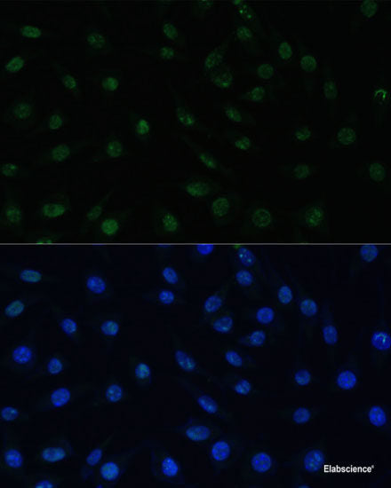 Western blot analysis of extracts of various cell lines using GALC Polyclonal Antibody at dilution of 1:1000.