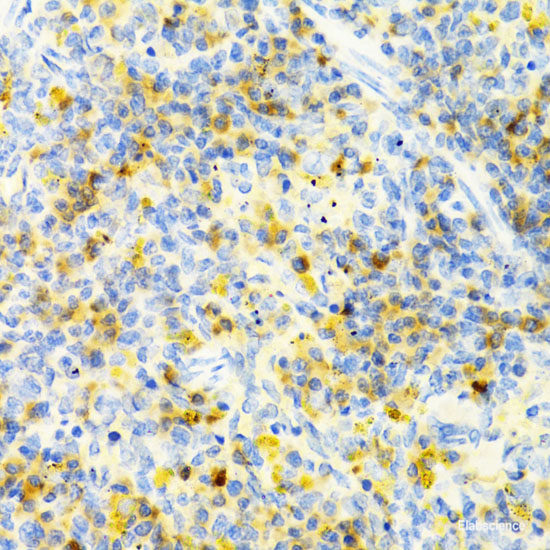 Immunofluorescence analysis of U2OS cells using PDK2 Polyclonal Antibody at dilution of 1:100. Blue: DAPI for nuclear staining.