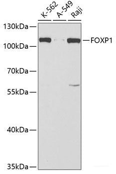 Western blot analysis of extracts of various cell lines using LITAF Polyclonal Antibody at dilution of 1:1000.