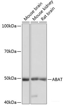 Western blot analysis of extracts of various cell lines using PSRC1 Polyclonal Antibody at dilution of 1:1000.