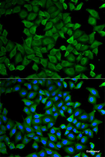 Western blot analysis of extracts of various cell lines using S100A11 Polyclonal Antibody at dilution of 1:1000.