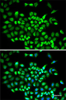 Western blot analysis of extracts of various cell lines using TXNRD2 Polyclonal Antibody at dilution of 1:1000.