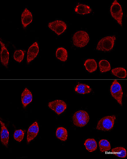 Western blot analysis of extracts of Jurkat cells using UMPS Polyclonal Antibody at dilution of 1:1000.