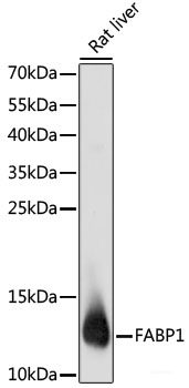 Immunofluorescence analysis of U2OS cells using UROD Polyclonal Antibody