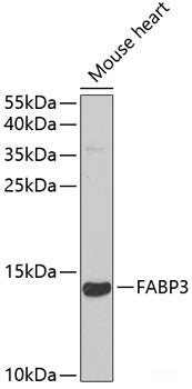 Western blot analysis of extracts of various cell lines using DNMT1 Polyclonal Antibody at dilution of 1:1000.