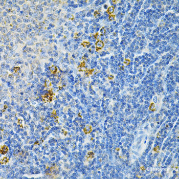 Immunofluorescence analysis of HeLa cells using SLC3A1 Polyclonal Antibody