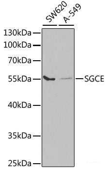 Immunohistochemistry of paraffin-embedded Rat liver using CBX6 Polyclonal Antibody at dilution of 1:100 (40x lens).