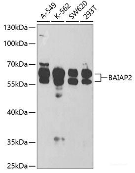 Immunohistochemistry of paraffin-embedded Human colon carcinoma using Snail Polyclonal Antibody at dilution of 1:100 (40x lens).