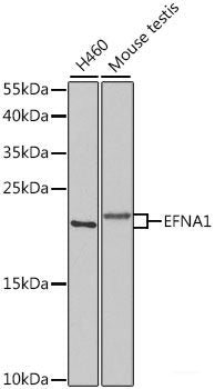 Immunofluorescence analysis of HeLa cells using NRF1 Polyclonal Antibody at dilution of 1:100. Blue: DAPI for nuclear staining.