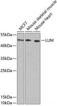 Western blot analysis of extracts of various cell lines using HAX1 Polyclonal Antibody at dilution of 1:1000.