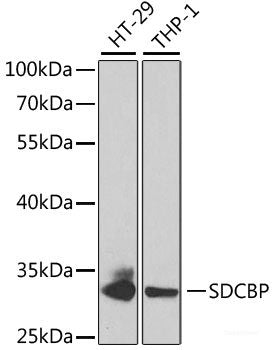 Immunofluorescence analysis of HeLa cells using RPLP0 Polyclonal Antibody