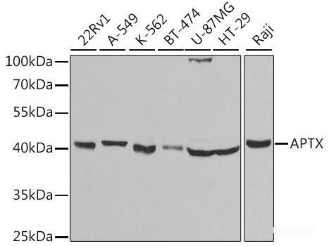 Western blot analysis of extracts of various cell lines using PSME2 Polyclonal Antibody at dilution of 1:1000.