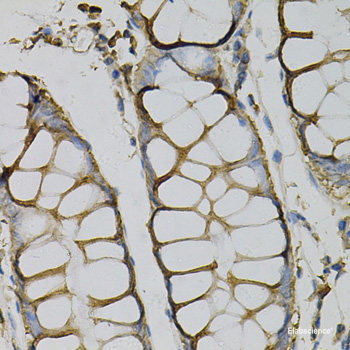 Immunohistochemistry of paraffin-embedded Rat kidney using SH2B1 Polyclonal Antibody at dilution of 1:100 (40x lens).