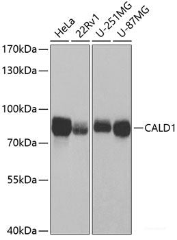 Western blot analysis of extracts of various cell lines using NFkB p100 / p52 Polyclonal Antibody.