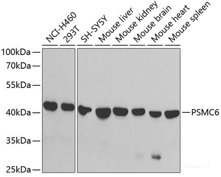 Western blot analysis of extracts of various cell lines using MLKL Polyclonal Antibody at dilution of 1:1000.