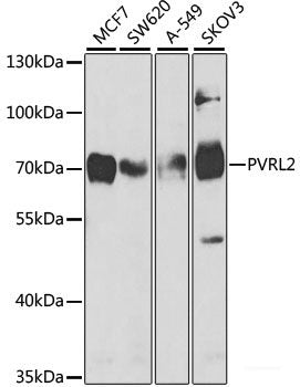 Immunohistochemistry of paraffin-embedded Human liver damage using FUBP1 Polyclonal Antibody at dilution of 1:100 (40x lens).