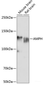 Immunohistochemistry of paraffin-embedded Rat testis using HPX Polyclonal Antibody at dilution of 1:100 (20x lens).