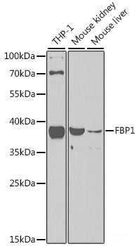 Immunofluorescence analysis of HeLa cells using LC3A/LC3B Polyclonal Antibody
